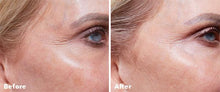 Load image into Gallery viewer, AnteAGE Home Microneedling Solution Kit
