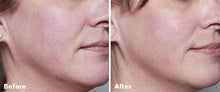 Load image into Gallery viewer, AnteAGE Home Microneedling Solution Kit
