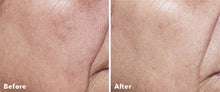 Load image into Gallery viewer, AnteAGE Home Microneedling Solution Kit

