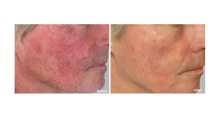 Load image into Gallery viewer, AnteAGE MD Serum
